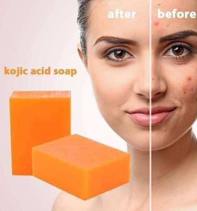 Kojie.san soap