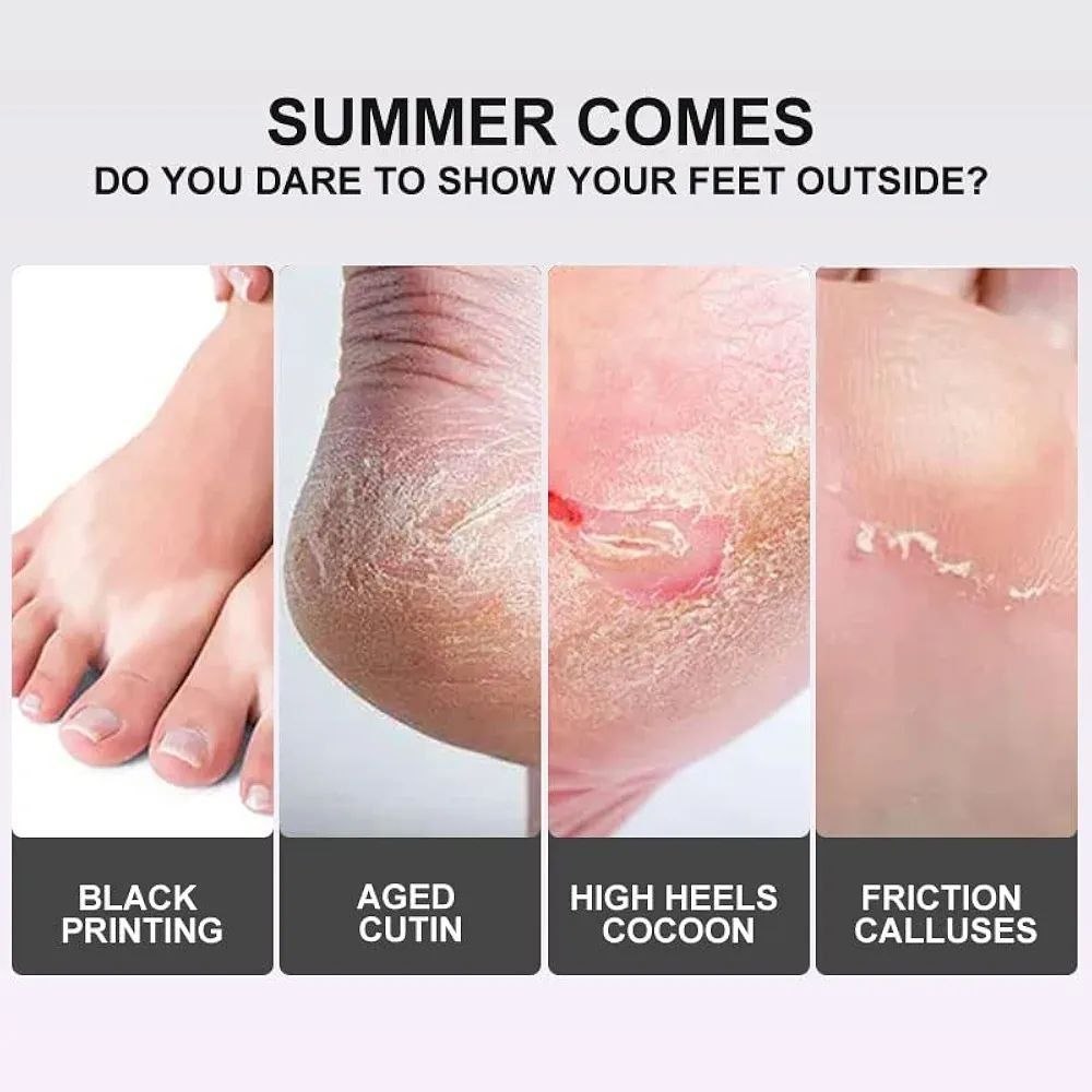 Exfoliating Foot Peel Mask — For Soft, Smooth & Callus-Free Feet